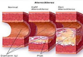 Kolesterol nedir?